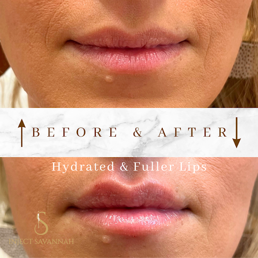 Inject Savannah created by Barbs By Kelly Medical Aesthetics