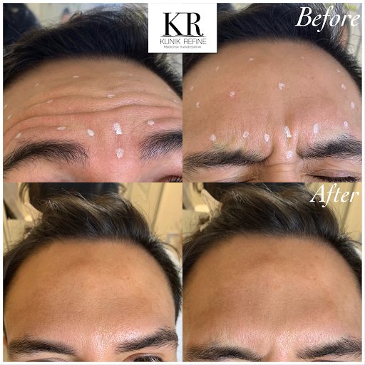 Klinik Refine - Thumbnail