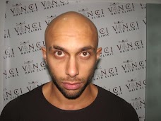 Vinci Hair Clinic manchester