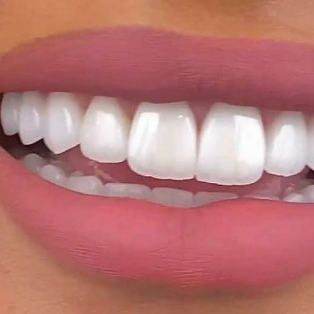 tukang gigi az zahra dental Klinik Gigi