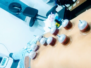 The suction and negative pressure provided by Hijama cupping can loosen muscles, encourage blood…