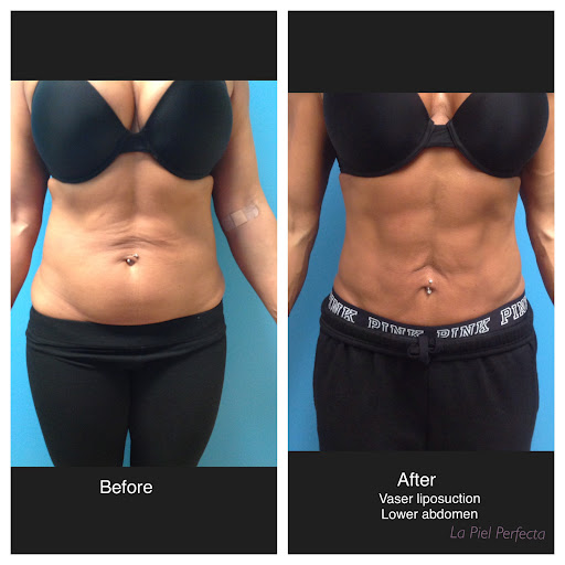 la Piel Perfecta laser center - Thumbnail