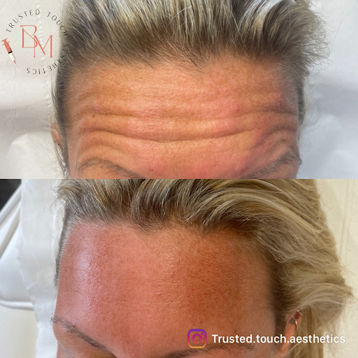 Trusted touch aesthetics