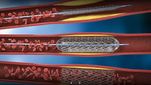 Photo n°2 de Docteur Tristan BOYER - Chirurgien Vasculaire - Saint-Tropez / Gassin à Gassin (Chirurgien vasculaire)