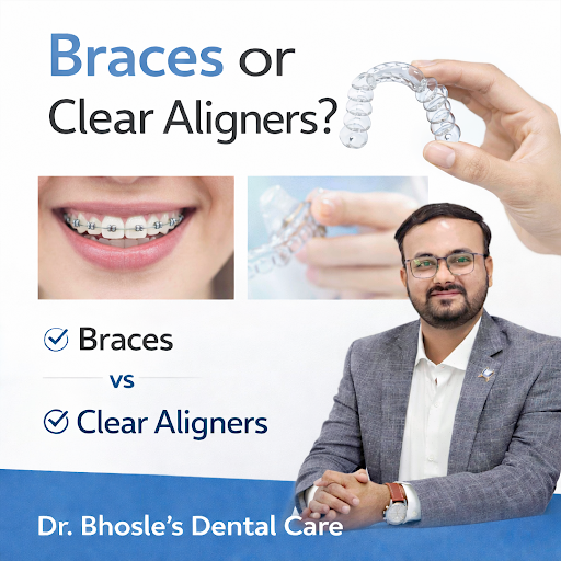 At Dr. Bhosle’s Dental Care & Orthodontic Center, we offer both traditional braces and clear alig… post image