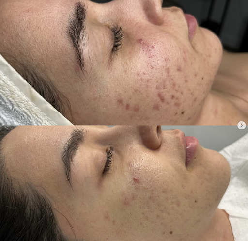 The Skin Room Brisbane - Thumbnail