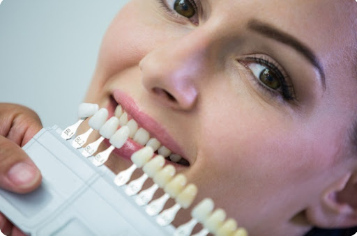 Aesthetic crown lengthening is a dental procedure that focuses on improving the appearance of the… post image