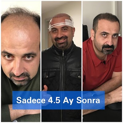 Dr. Sait Can Saç EKim ve Estetik Merkezi