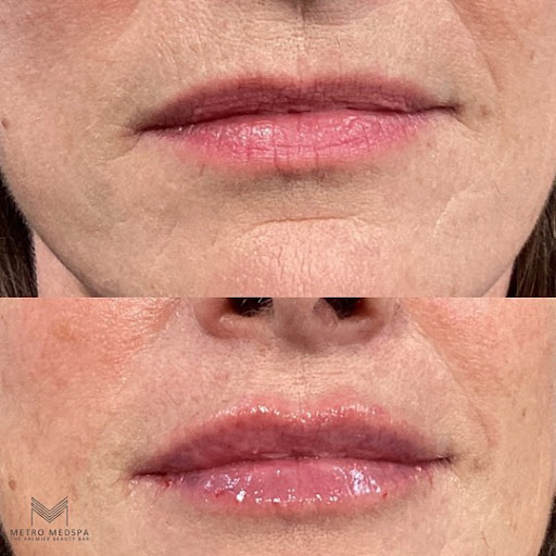 Metro Medspa