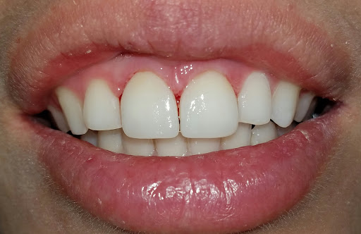 Peter Do DDS - Escondido Dentist, Implant Dentist - Thumbnail