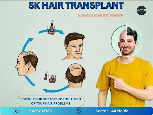 Are you looking for economical hair transplant services? SK Hair Transplant Clinic in Sector 44,…