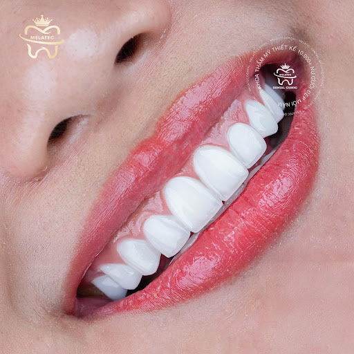 Melatec Dental Clinic photo 5