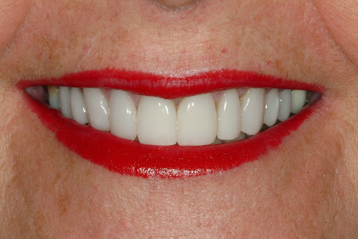 Meadowlark Dental Associates - Kearney, NE