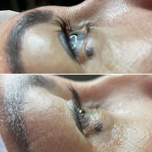 Miranda Beauty Touch Massage Beauty & Aesthetic Services Clinica Raulfisio Fisioestética Estética Avanzada - Thumbnail