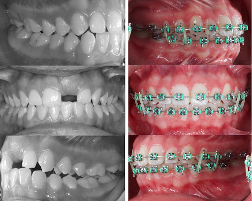 Dentalixt - Visual
