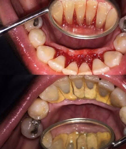 Smile Care Consultorio Dental - Thumbnail