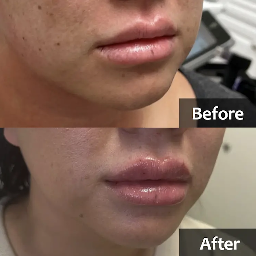 Mia Medical Spa