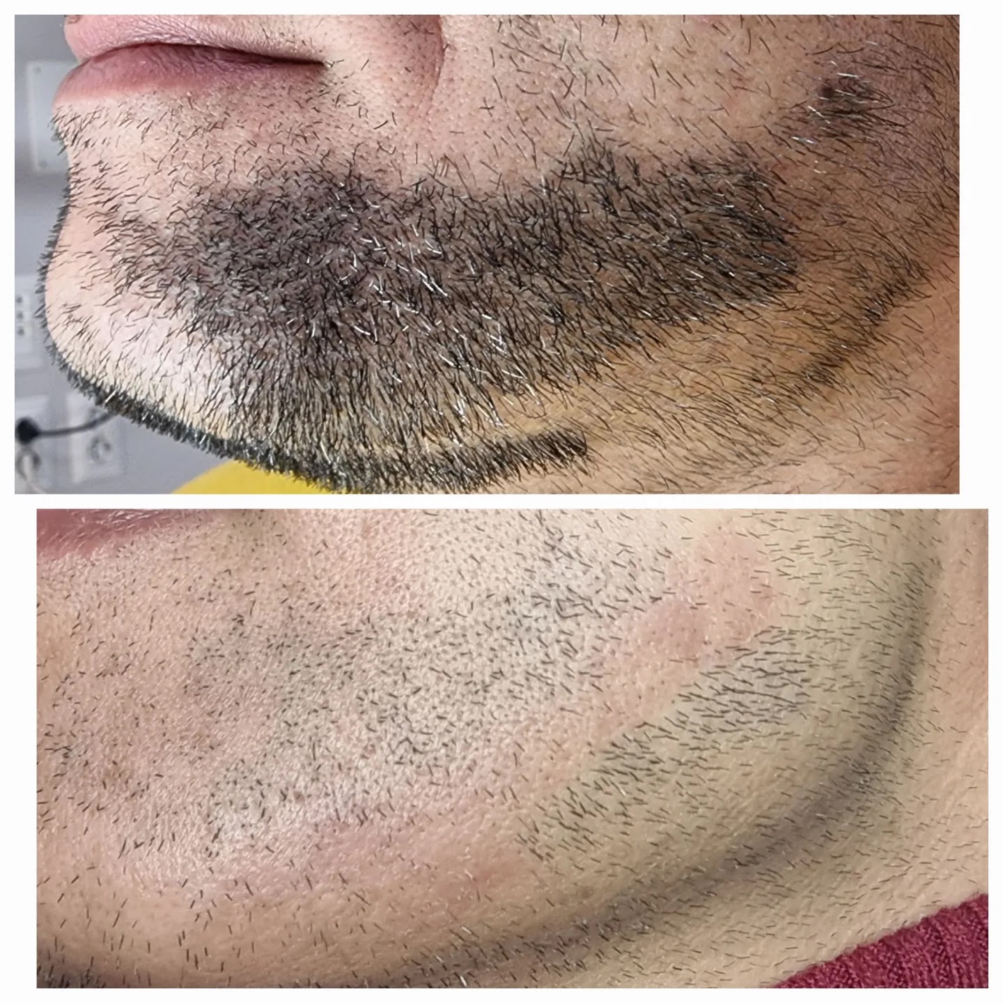 Alveda Epilazione Definitiva 16