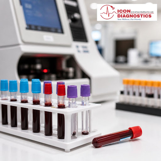Understanding your heart health starts with the right tests. At Icon Diagnostic & Sonography Cent… post image
