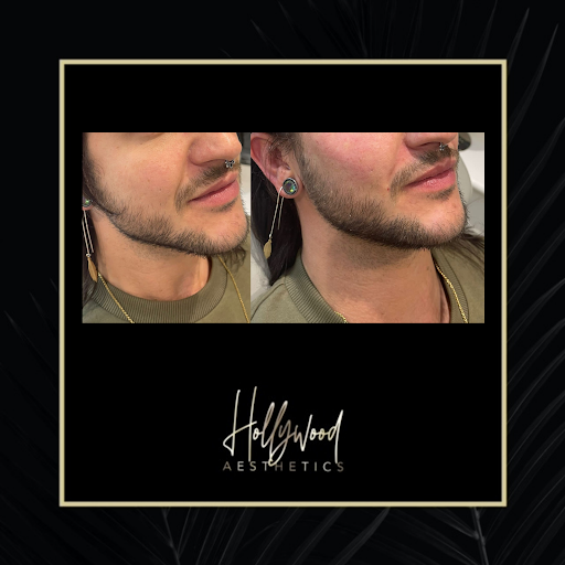 Hollywood Aesthetics - Thumbnail
