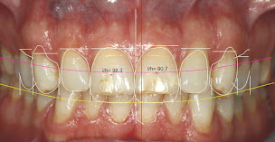 Photo n°9 de Docteur Arnaud RINDEL à Mérignac (Cabinet dentaire)
