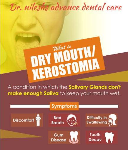 Dry mouth treatment restores natural salivary flow, relieves continuous oral irritation, and shie… post image