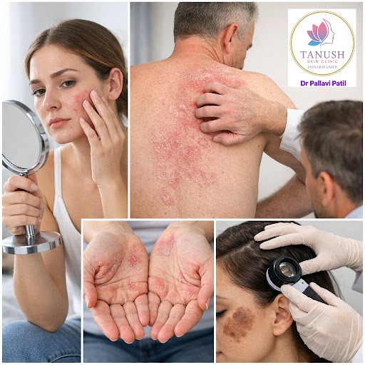 Is your skin trying to tell you something? At Tanush Skin & Hair Clinic in Bhiwandi, we help you… post image