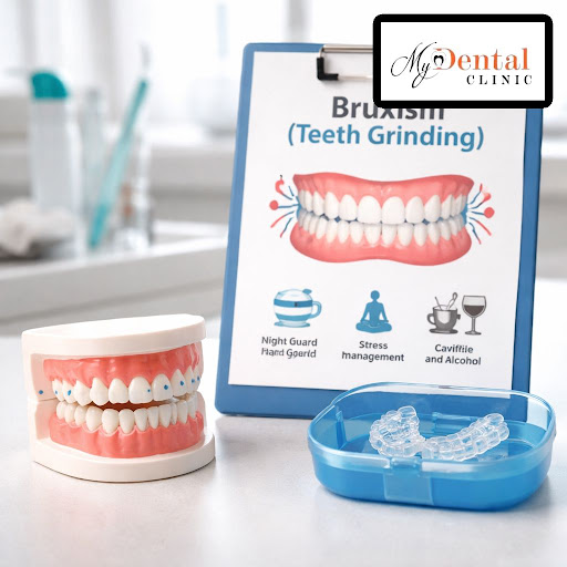 Do you wake up with jaw pain, headaches or sensitive teeth? You may be grinding your teeth in you… post image