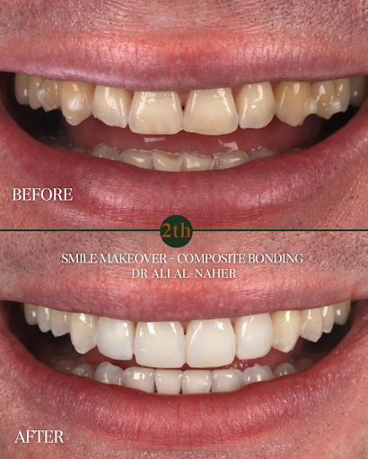 Twoth Dental + Facial Aesthetics, St John’s Wood - Dental Phobia Experts