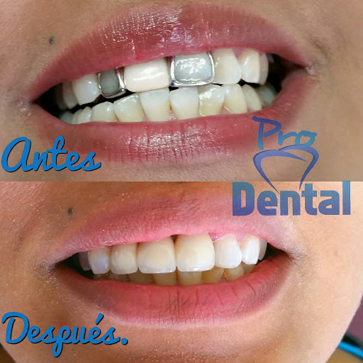 Consultorio dental ProDental San Cristóbal de Las Casas - Thumbnail