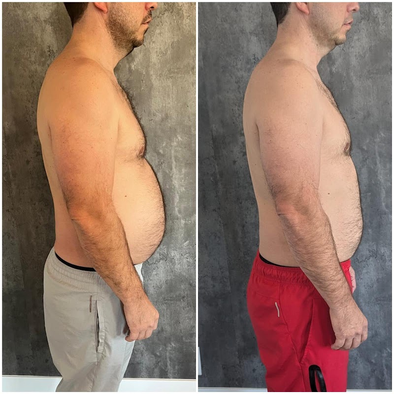 Layton Weight Loss Clinic