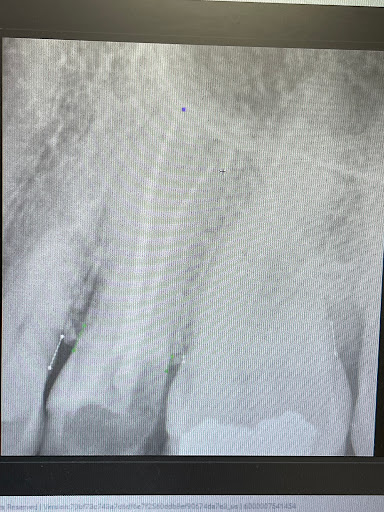 The Pearl Dentistry of Sarasota - Thumbnail