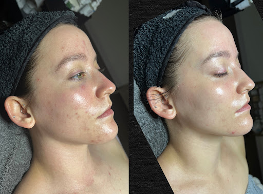 Skin Avenue - Thumbnail