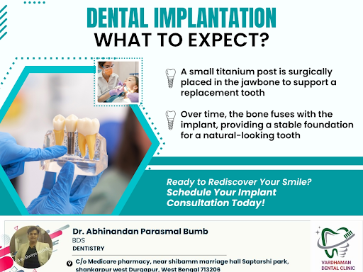 The dental implantation process involves several stages. Initially, the dentist conducts a thorou… post image