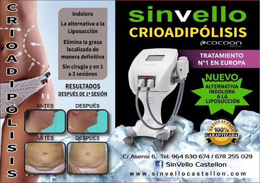 Sinvello - Thumbnail
