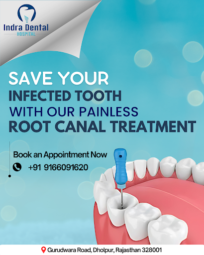 Don’t let tooth pain take over your smile! Our painless root canal treatment helps save your natu… post image