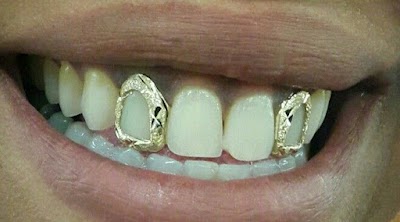 Right Shyne Grillz