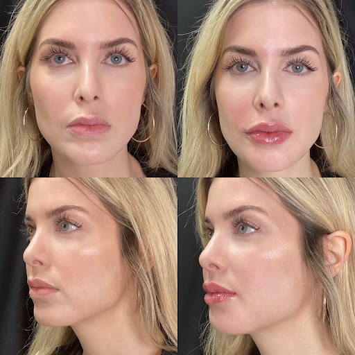 Smiley Aesthetics Medical Spa - Botox & Weight Loss Clinic Bowling Green