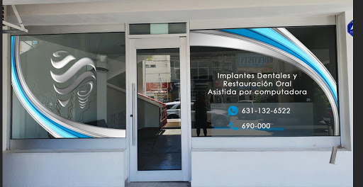 Implantes dentales y restauración oral asistida por computadora - Thumbnail