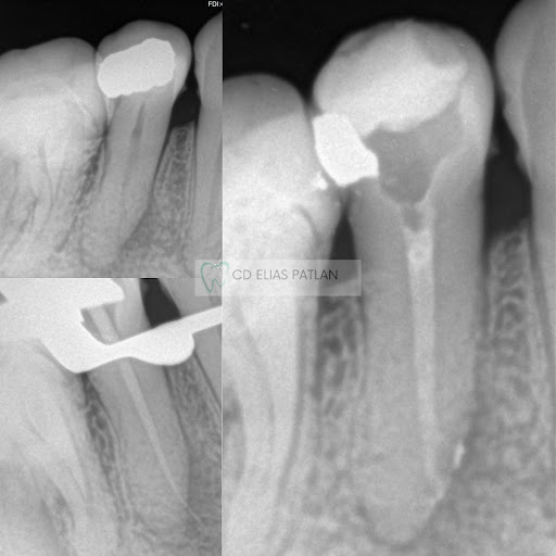 Clinica dental Vida dental - Thumbnail