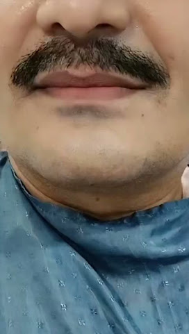 Eledent Dental Hospital | Best Dental Clinic in Kondapur, Hyderabad by null