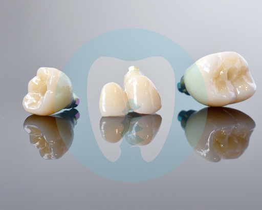 Perth Dental Implant Centre - East Vic Park