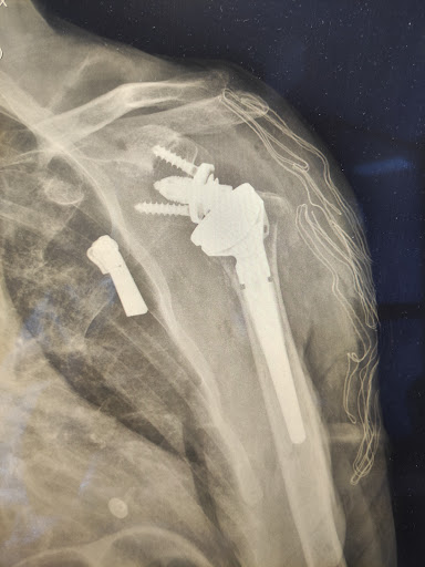 Dr. Gennaro Campopiano, Ortopedico - Thumbnail