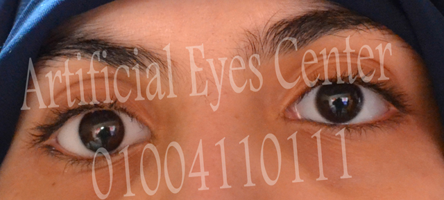 Artificial Eyes Center, Author: مركز العيون الصناعية