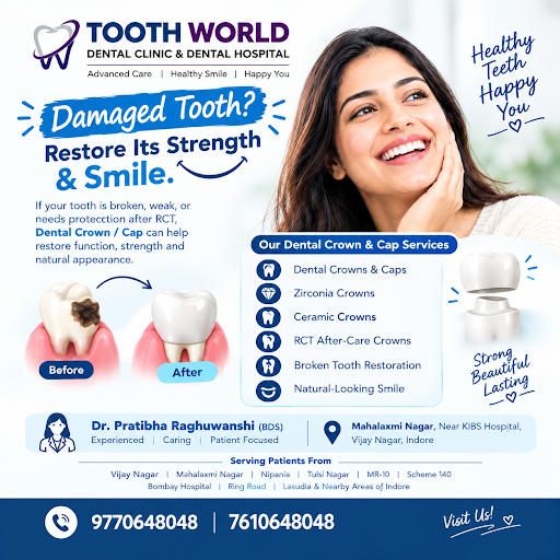 🦷 Dental Crowns & Caps in Indore post image