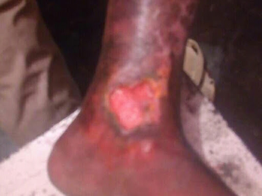 Cured within 2 weeks  (Dr Soumya Dey's Clinic desk)  post image