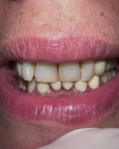 Opinii despre Dental Smile în Αχαρνές - Οδοντίατρος