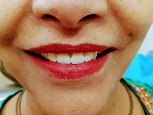 Full mouth treatments in just 2-3 sitting and at affordable rates.Most modern technology availabl…