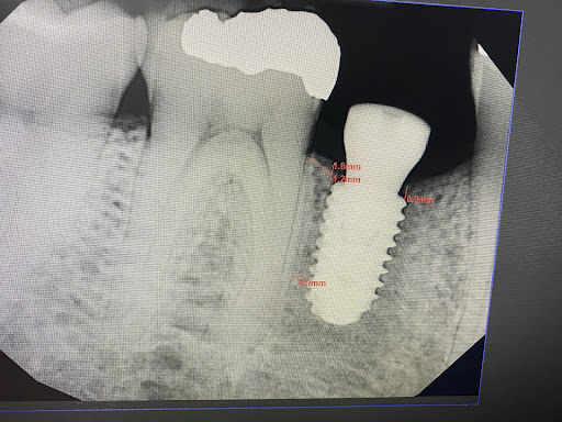 Lehigh Valley Cosmetic Dentistry - Thumbnail