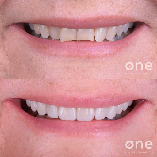 Clínica Dental Marbella Øne Clinic - Thumbnail